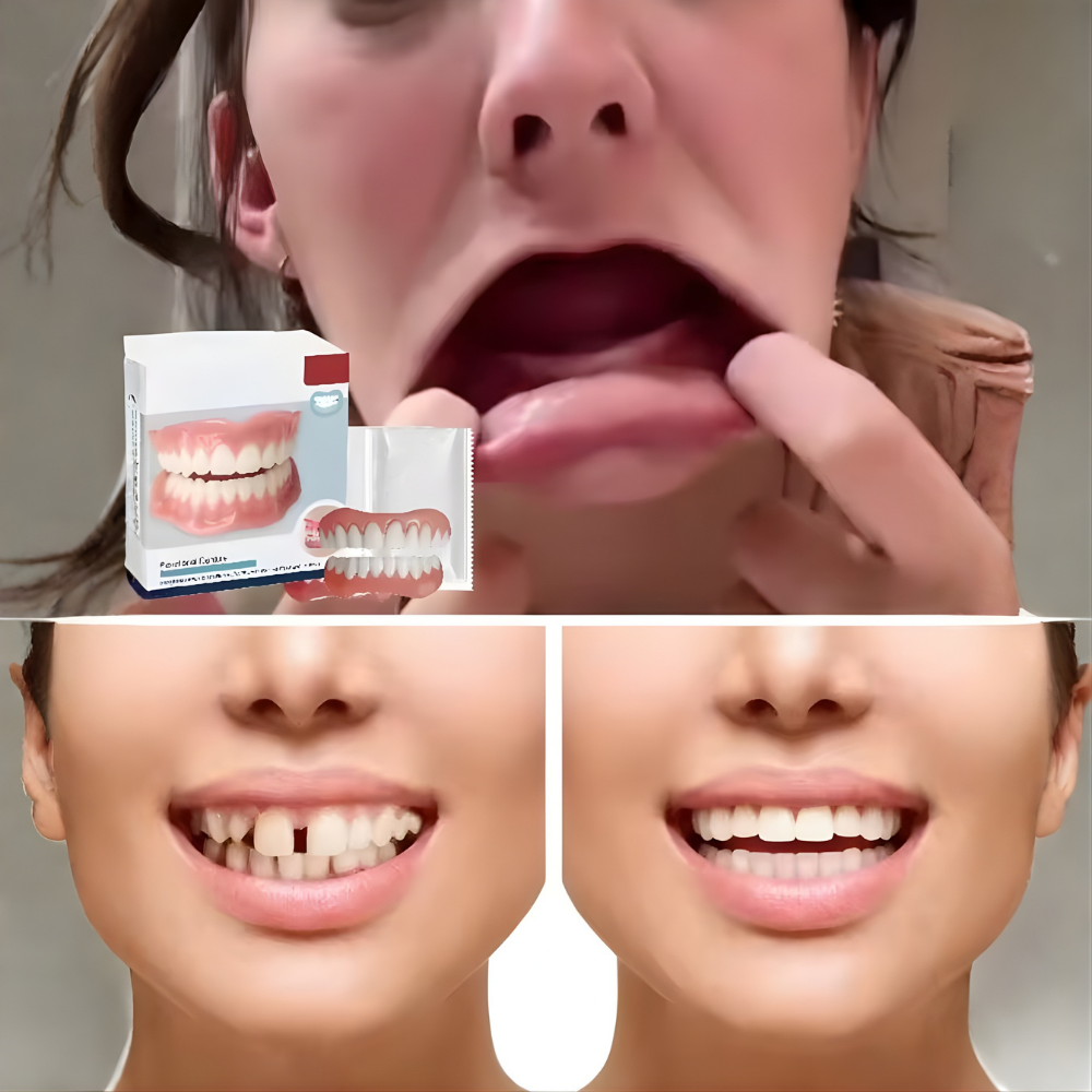 Prothèse dentaire ajustable amovible pour mâchoire complète – Image 2