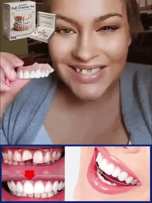 Prothèse dentaire modelable antidérapante hygiénique – Image 6