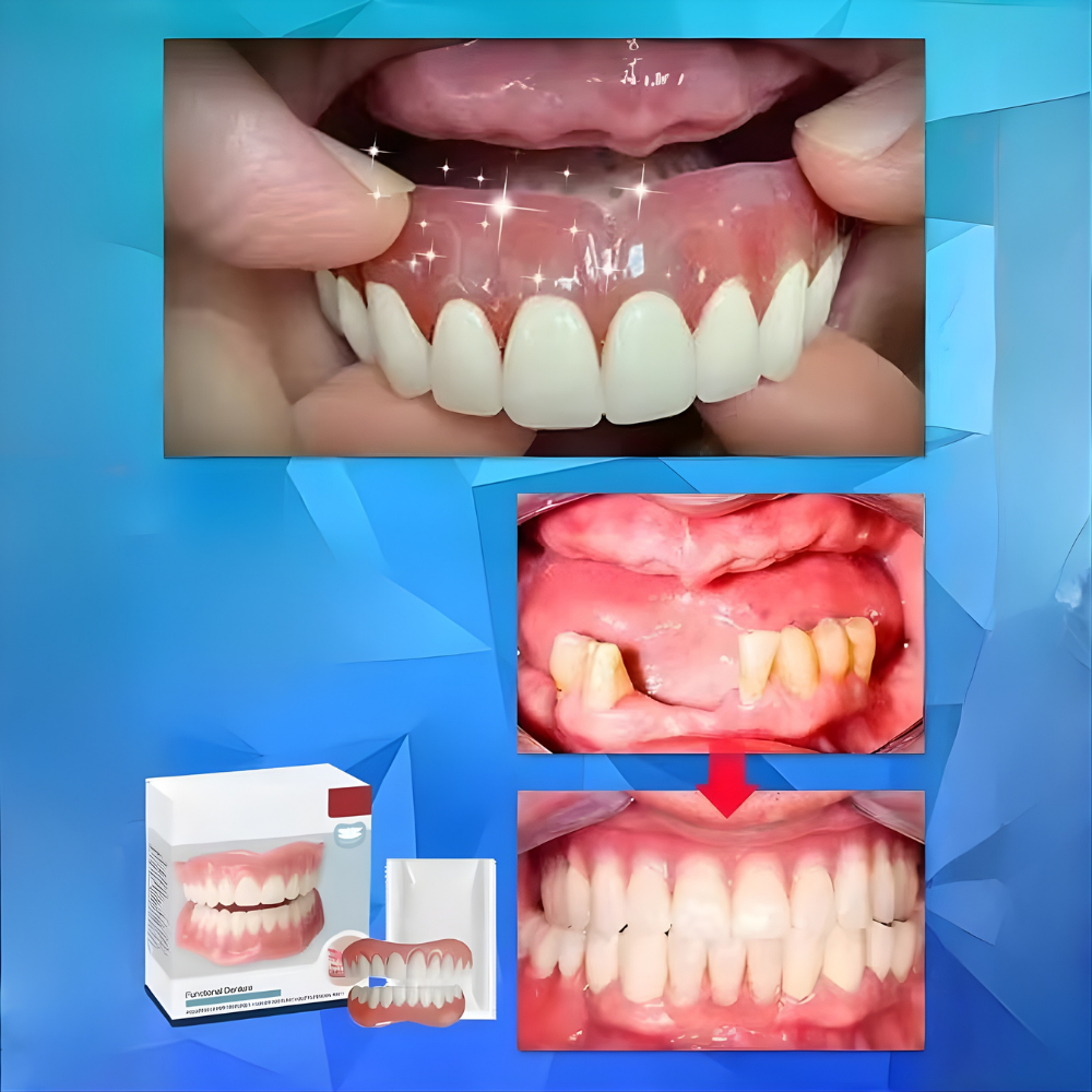 Prothèse dentaire ajustable amovible pour mâchoire complète – Image 4