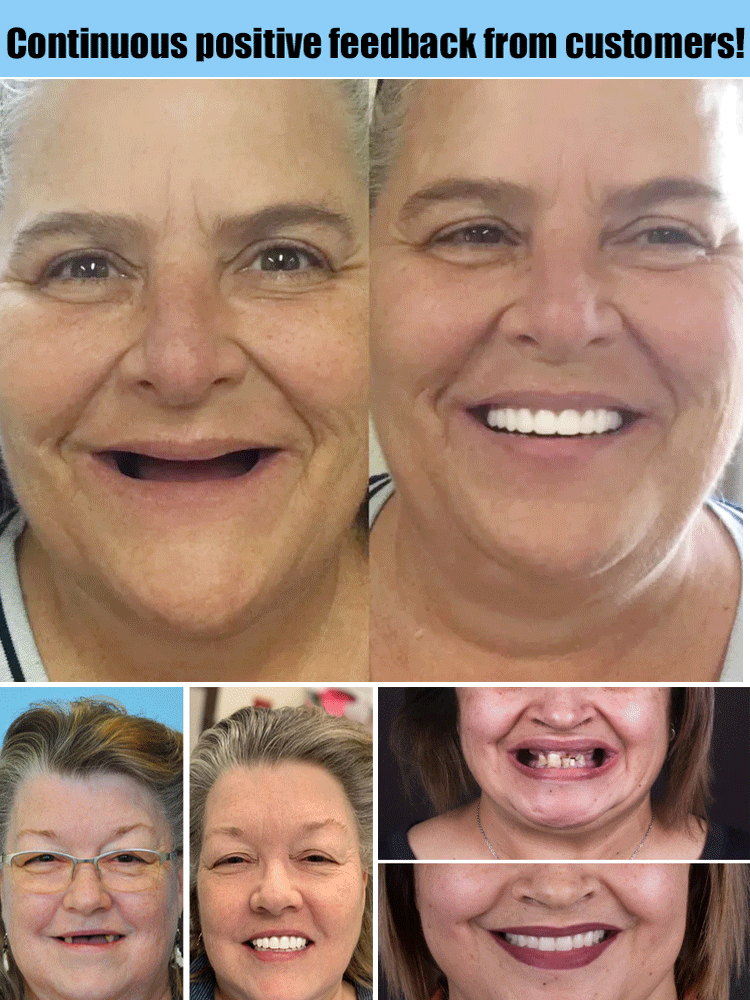 Prothèse dentaire modelable antidérapante hygiénique – Image 4