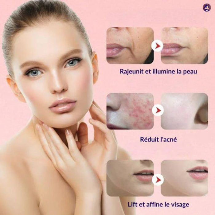 Appareilliftingvisage_Leseffetsavant_apres_480x480