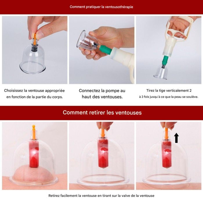 Cupping_Therapy_Set_-_32PCS_Cupping_Vacuum_Massage_Cups_Set_Therapy_Health_Acupuncture_Suction_Magnet_4 (1)